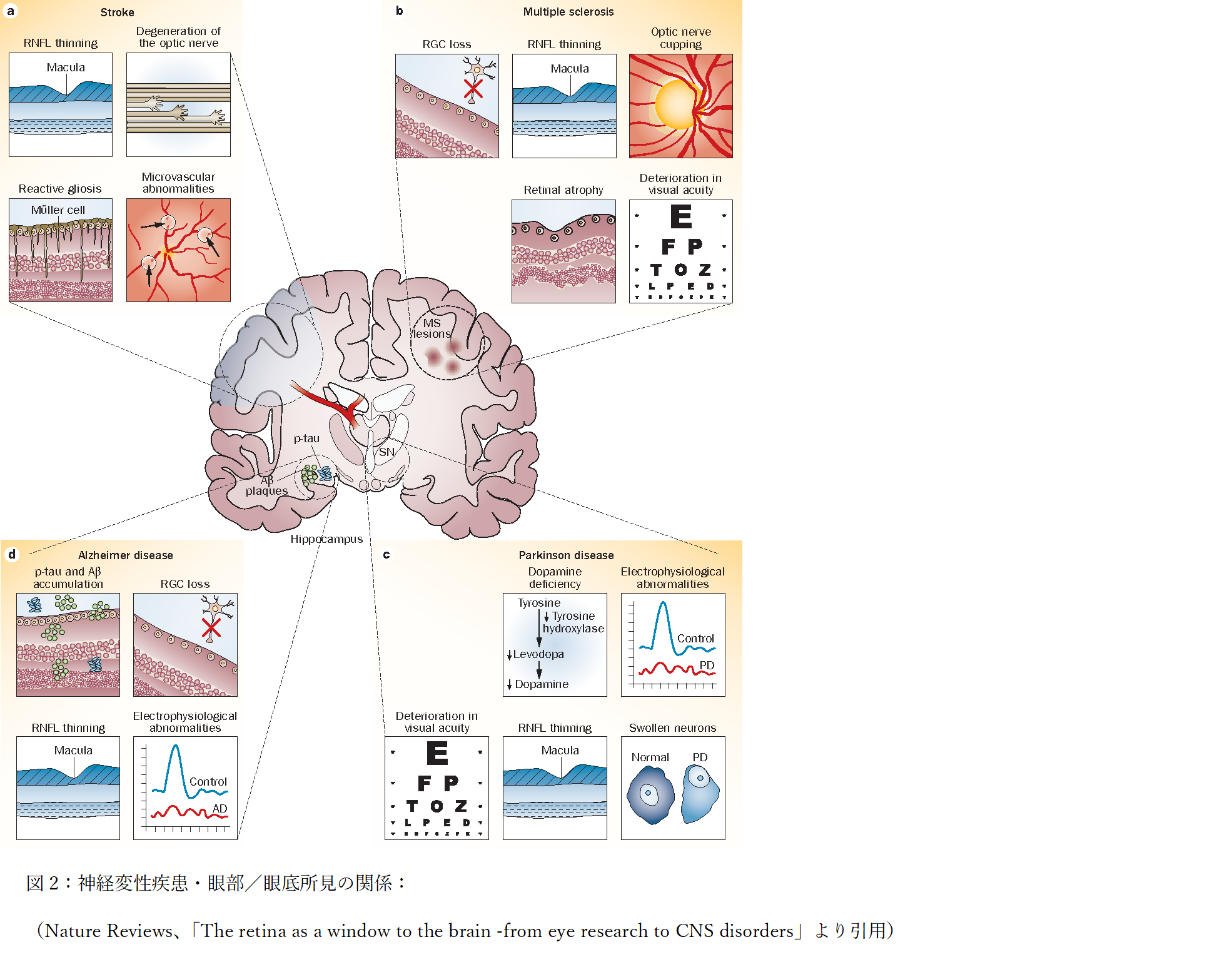 図2：神経変性疾患・眼部／眼底所見の関係